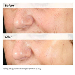 Ordinary Buffet Serum