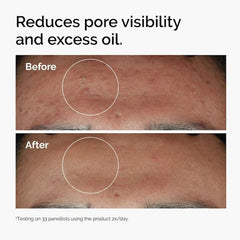 Ordinary Buffet Serum