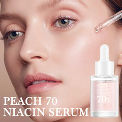 Niacinamide Serum Dark Spot Remover Fade Acne Marks
